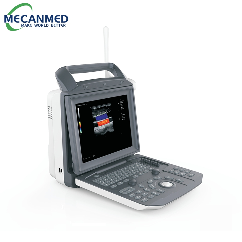 Escáner de ecocardiografía digital portátil completo, máquina de ultrasonido Doppler color portátil para embarazo