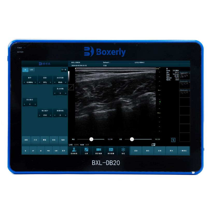Bxl-Db20 Máquina de ultrasonido bovino Sistema de imagen reproductiva de ganado