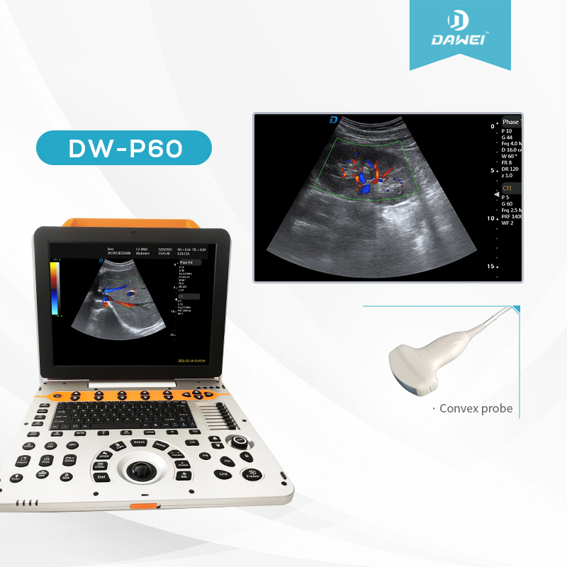 15 Sistema de Ultrasonido Portátil de 8 Pulgadas para Cardiología Abdominal Obstetricia Dw-P60