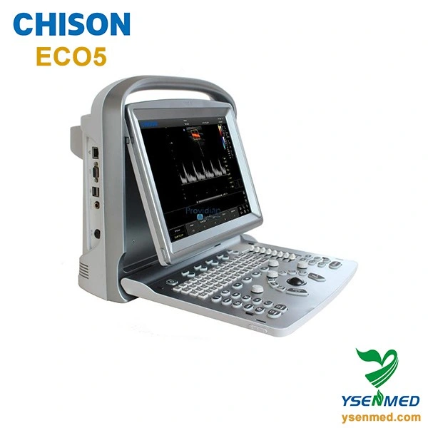 Equipo Médico Chison Eco5 Ecógrafo Doppler Color Portátil
