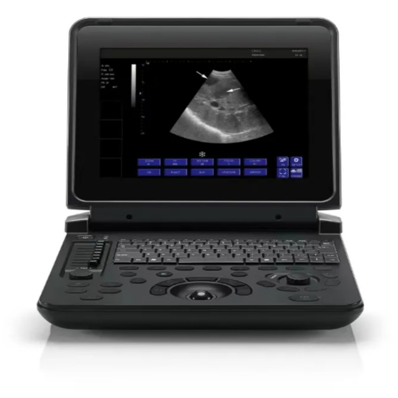 Escáner de ultrasonido para embarazo veterinario portátil, sistema de diagnóstico Doppler color para ganado, ovejas y caballos