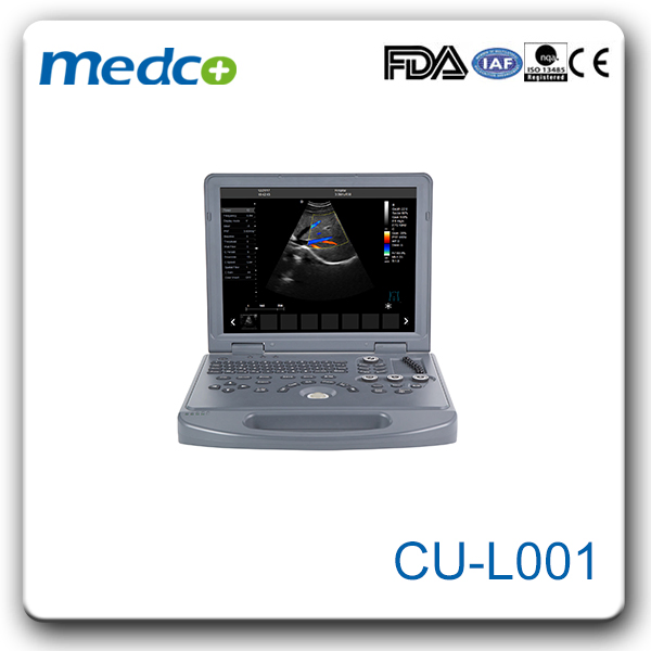 Sistema de diagnóstico por ultrasonido Doppler color para equipos hospitalarios
