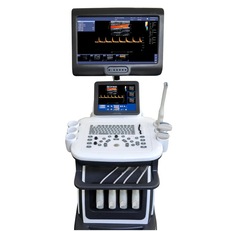 Máquina de diagnóstico por ultrasonido Doppler de color