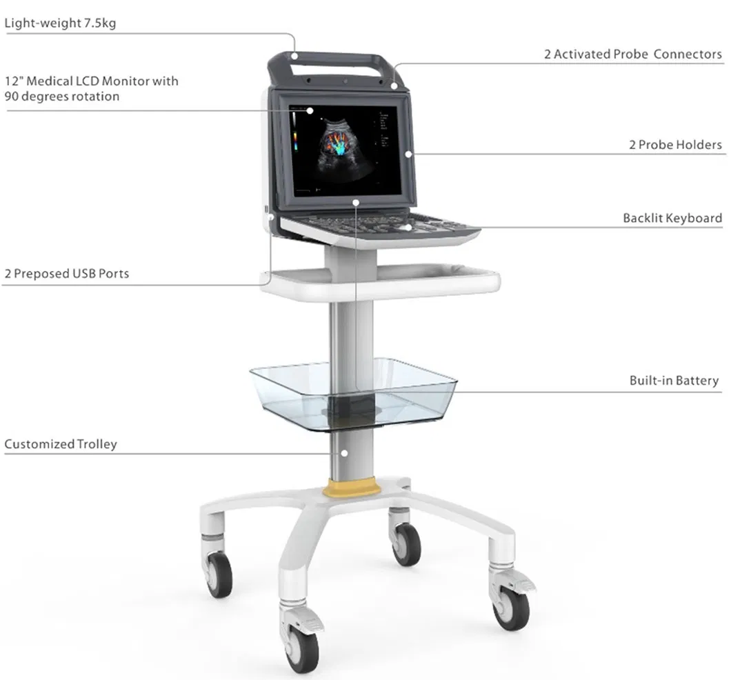Sistema de ultrasonido cardíaco portátil con ecógrafo color Doppler para laptop