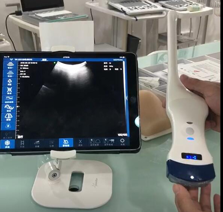 My-A010j-C Dispositivo médico sonda inalámbrica escáner de ultrasonido portátil
