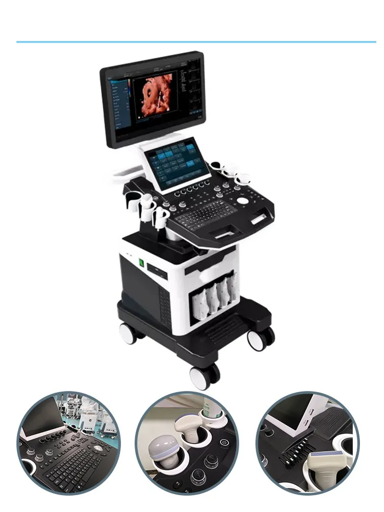 Sistema de ultrasonido Doppler color Trolley