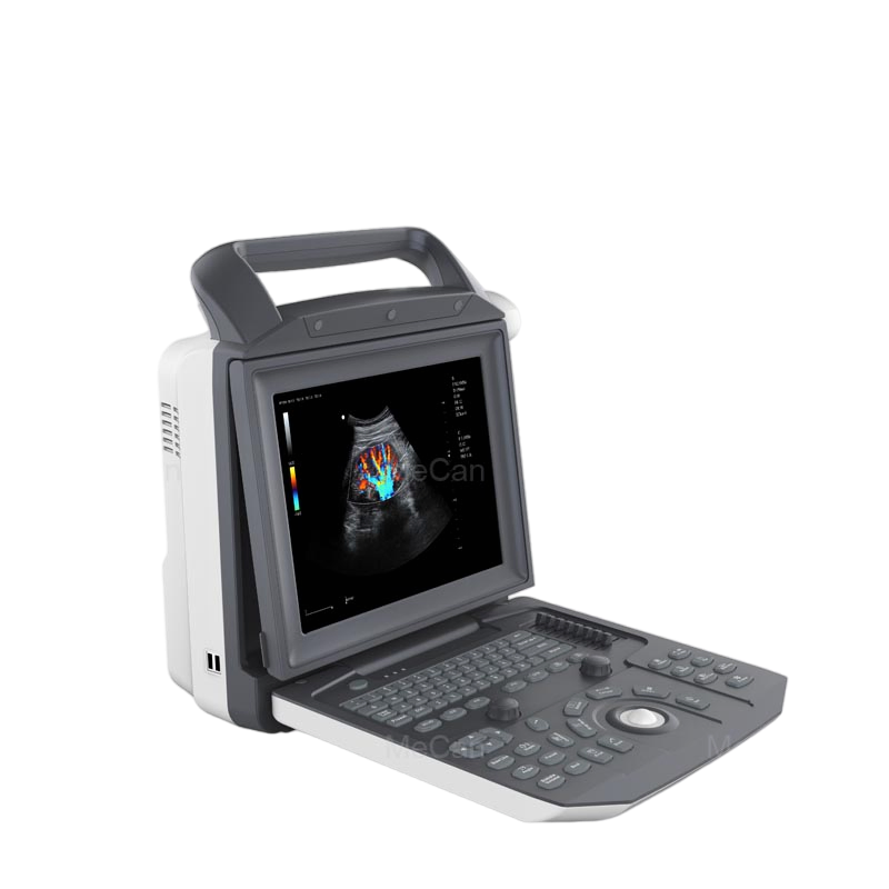 Venta Caliente Reparador de Sonda Doppler Vascular Cardiovascular de Abdomen Máquina de Ultrasonido Chison