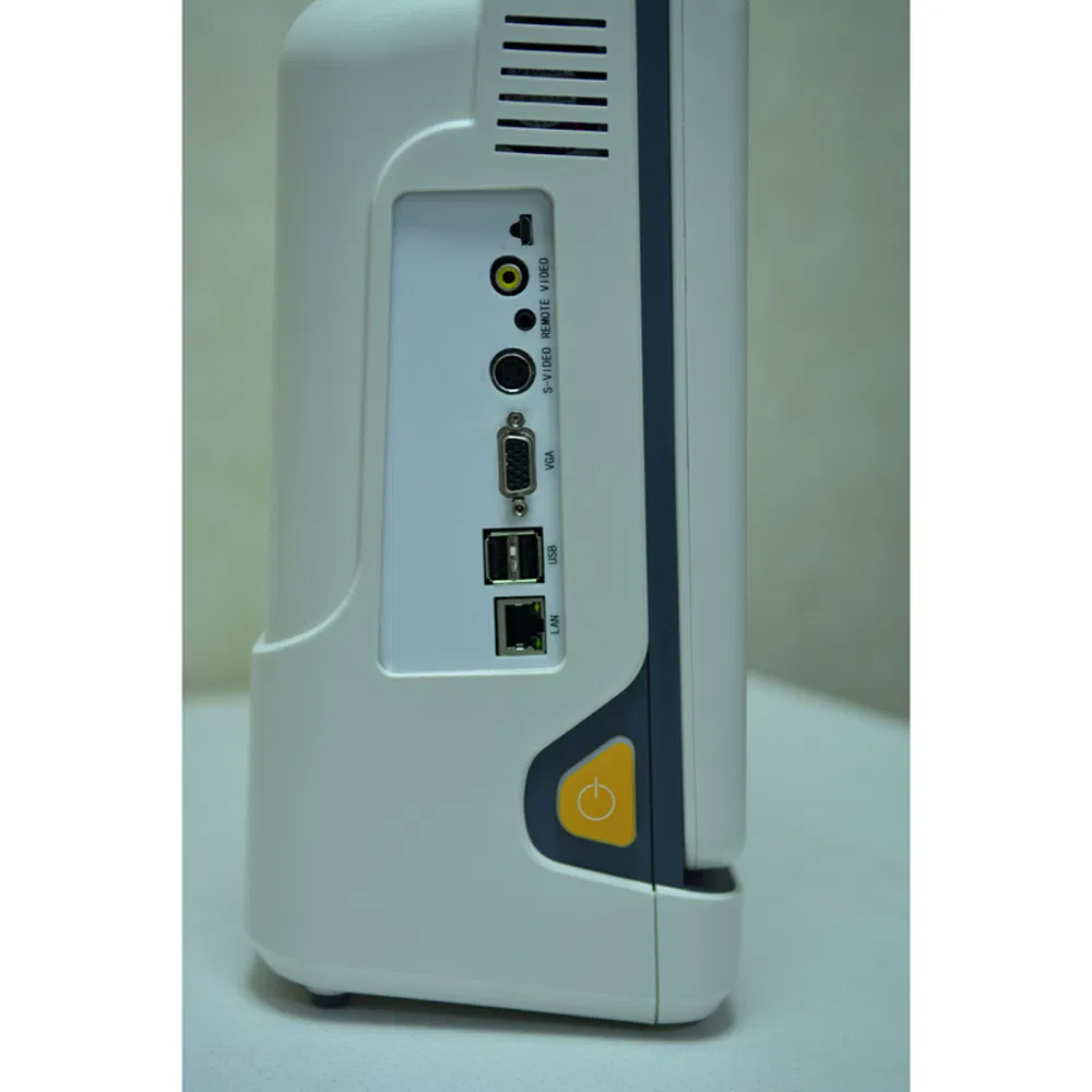 Precio de fábrica al por mayor sistema de diagnóstico ultrasónico Doppler color portátil digital completo