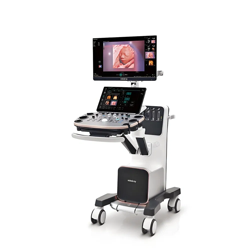 Máquina de Ultrasonido Profesional para Embarazo Mindray Nuewa I9 con Doppler Color para Obstetricia y Ginecología