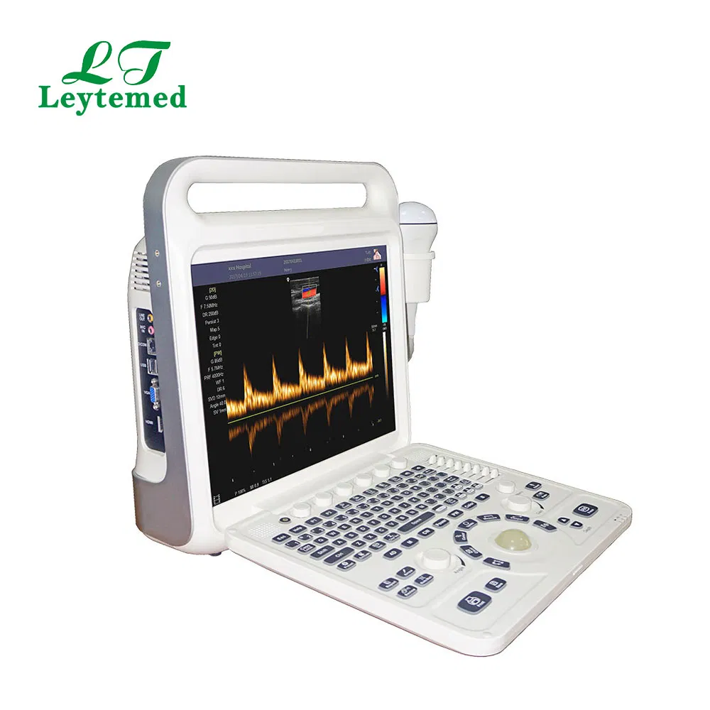 Ltub63 Urología Cardíaca Ginecología Obstetricia USG Doppler Color 4D Máquina de Ultrasonido