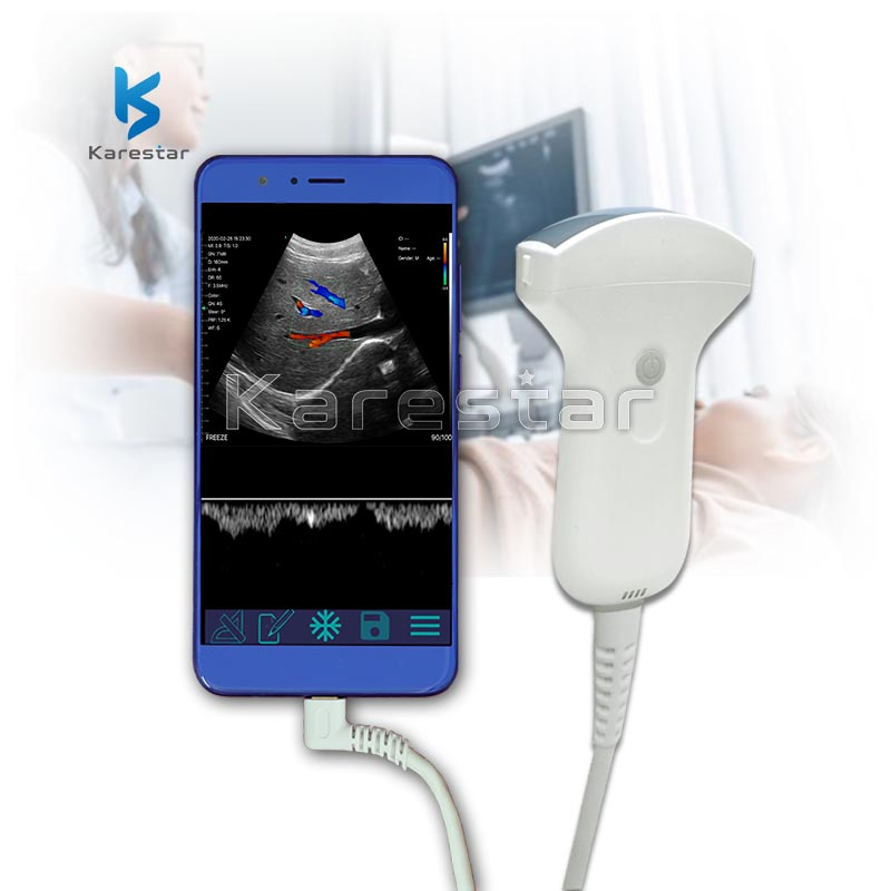 Escáner ultrasónico portátil inalámbrico con Doppler de color, sonda convexa de bolsillo