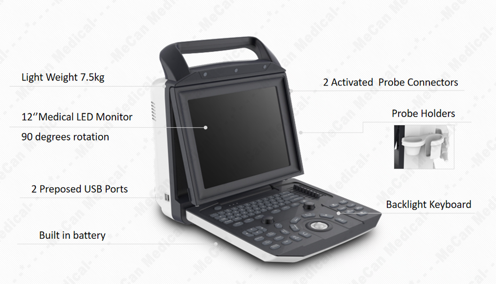 Escáner de ecocardiografía digital portátil completo, máquina de ultrasonido Doppler color portátil para embarazo