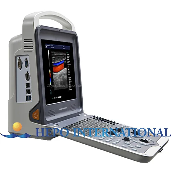 HP-UC700 Diagnóstico Médico
