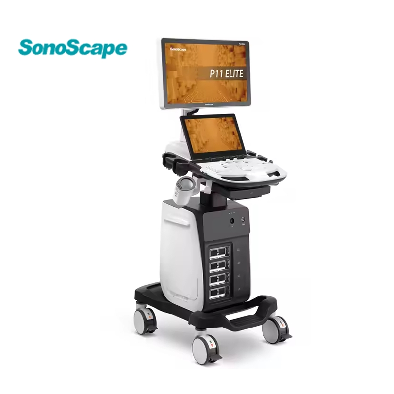 Sonoscape P11 Instrumentos de ultrasonido médico baratos Máquina de ultrasonido en blanco y negro Ecógrafo portátil Escáner de ultrasonido