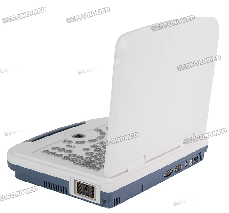 Máquina de Ultrasonido Médico en Blanco y Negro Sistema de Diagnóstico Ultrasonico Me-580 W1.0