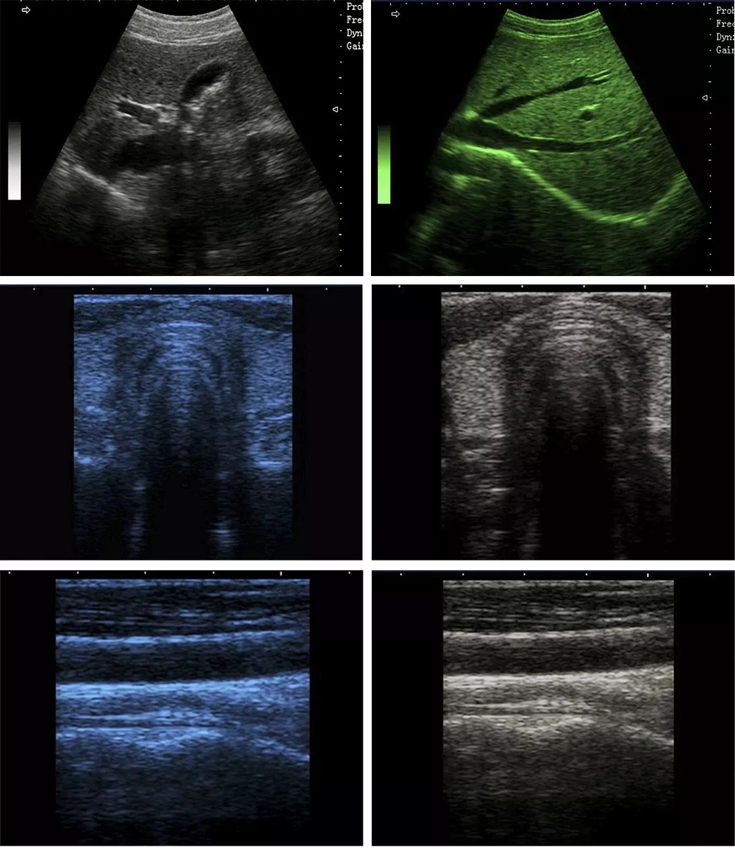 Imagen de ultrasonido clínica