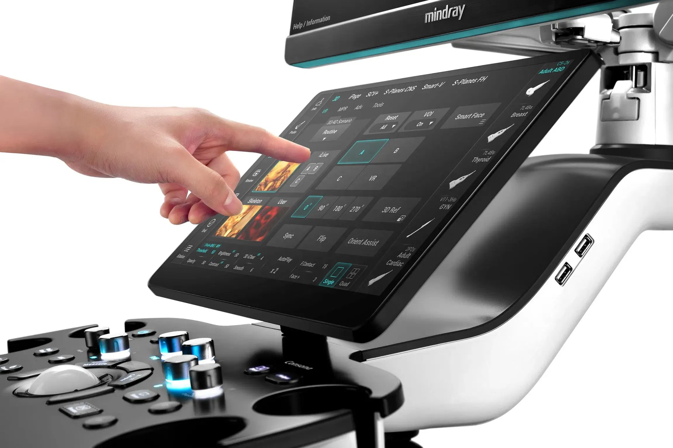 Máquina de ultrasonido Doppler color cardiovascular obstétrico ginecológico Mindray Consona N6 N7 N8 N9 de alta venta