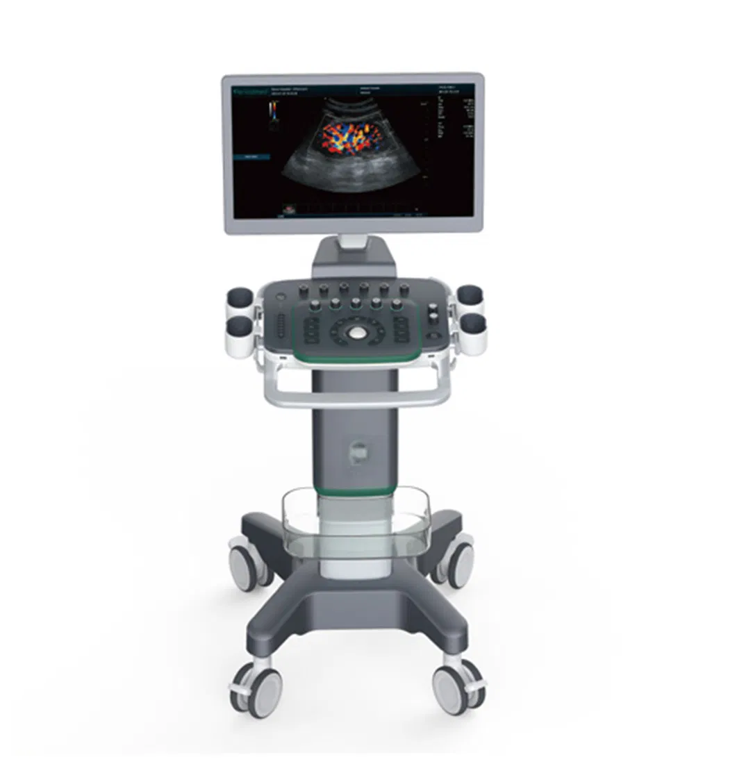 Dispositivo de Ultrasonido Médico de Imagen Digital Avanzada 4D Sistema de Diagnóstico Doppler Color Visual