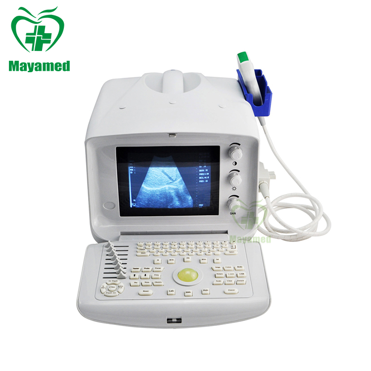 My-A001-N Escáner Ultrasónico Portátil Digital en Blanco y Negro Precio de la Máquina