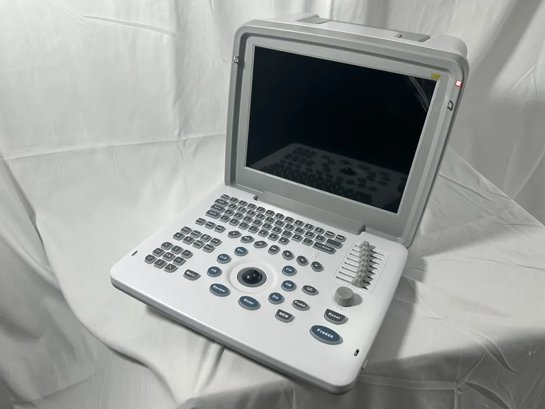 Scanner de Embarazo