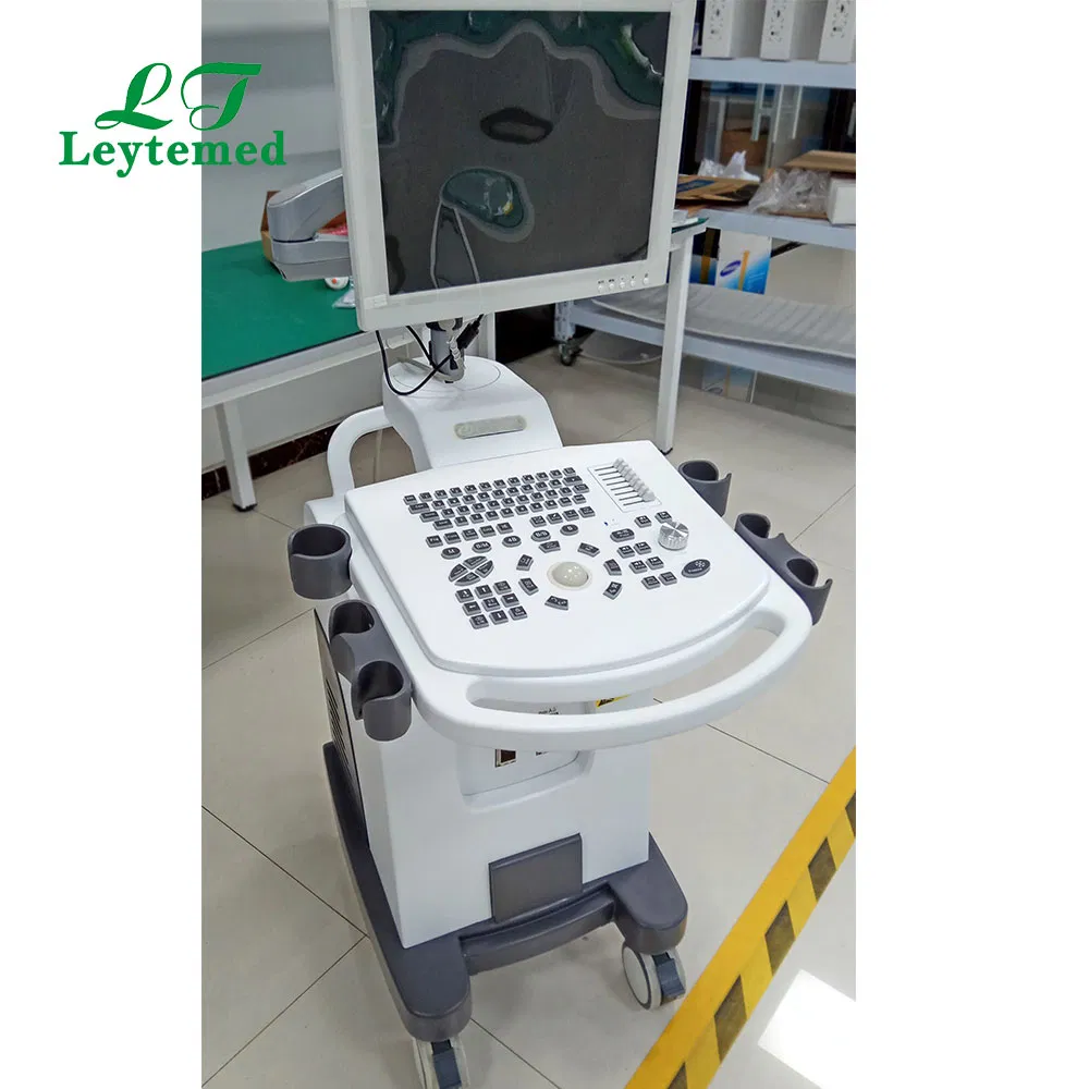 Ltub46 Sistema de Ultrasonido Diagnóstico Básico Trolley Bw Precio