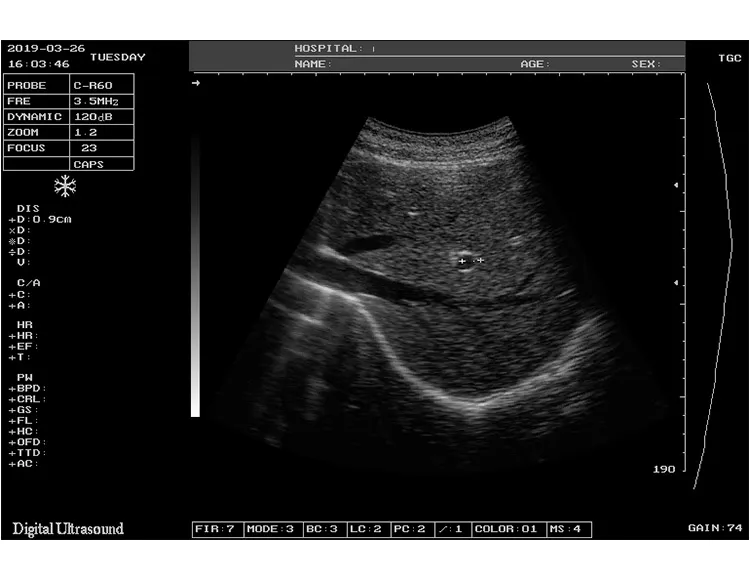 Imagen Ultrasonido 1