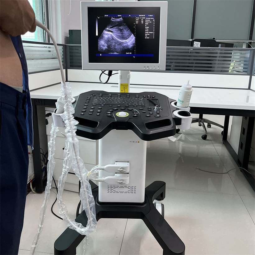 Máquina de diagnóstico ultrasónico digital en blanco y negro de fábrica directa