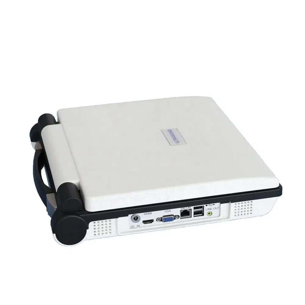 3D 4D Sistema de Ultrasonido Cardíaco Portátil Ecógrafo Color Doppler Laptop