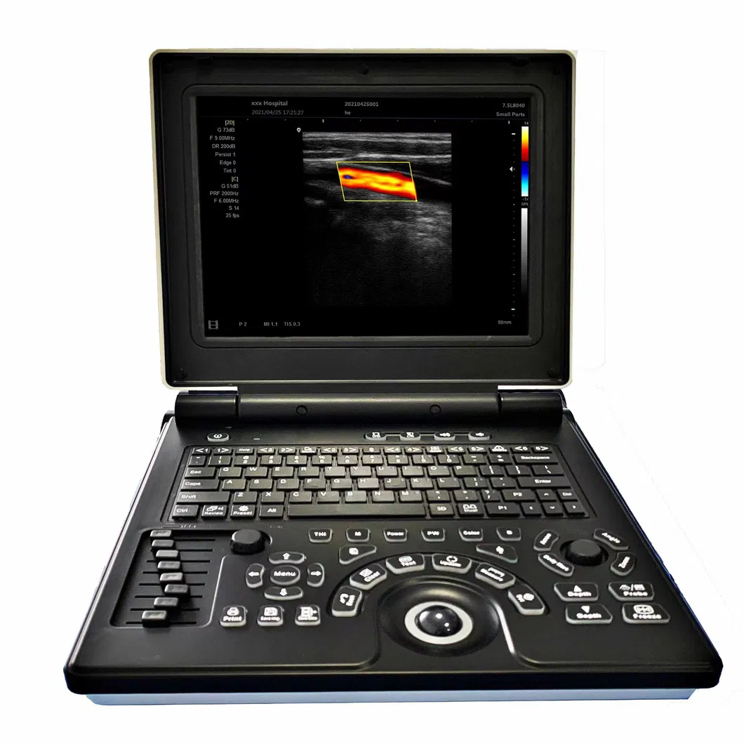Sistema Doppler E20