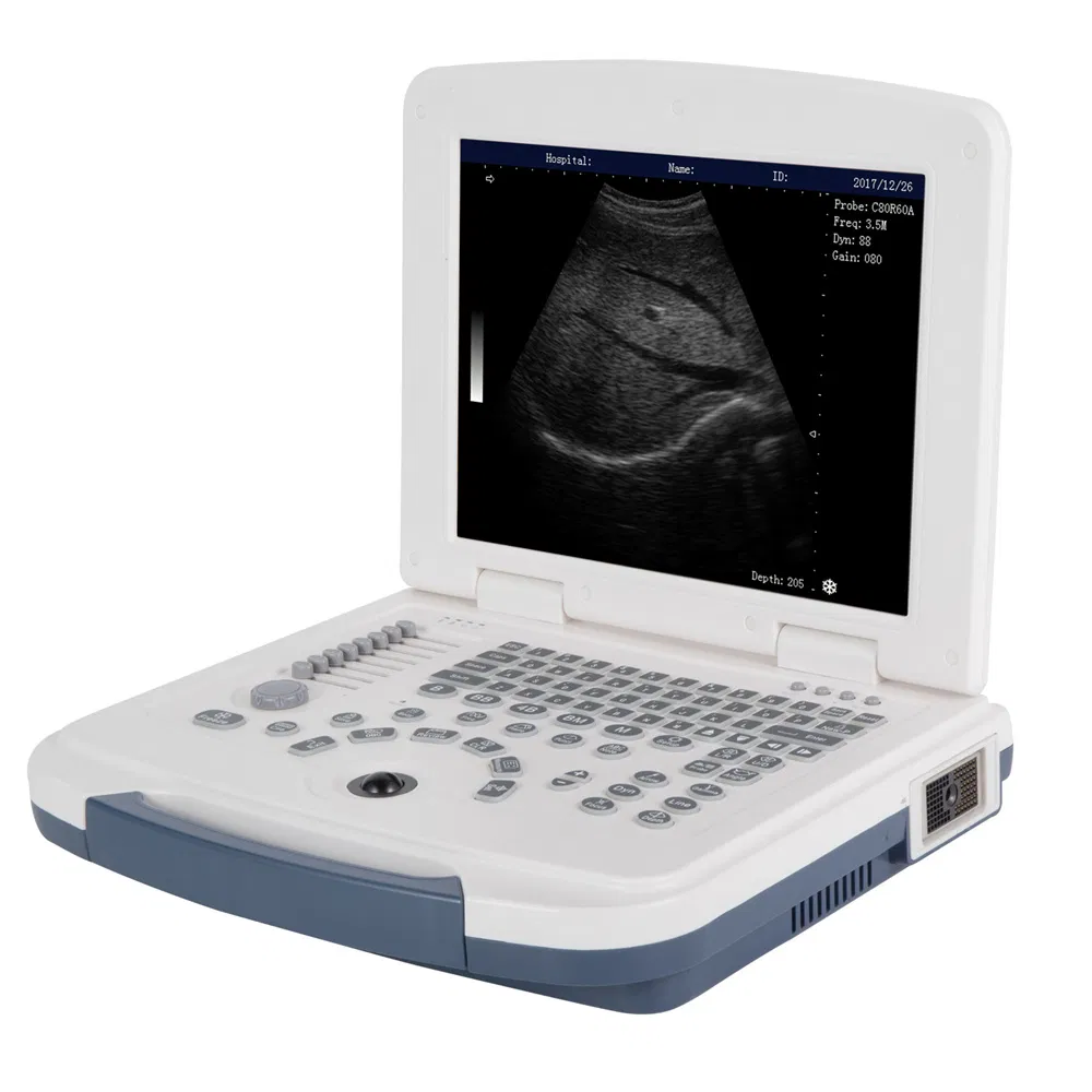 Equipo de diagnóstico médico portátil de ultrasonido para embarazo