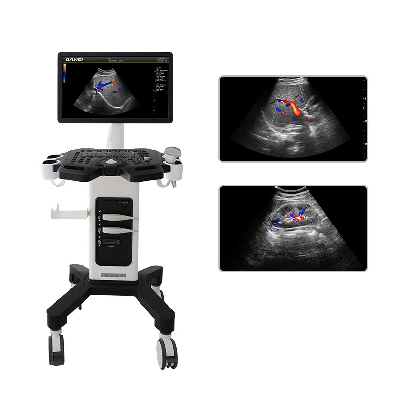 Dw-F3 Máquina de ultrasonido Doppler color digital avanzada para hospitales