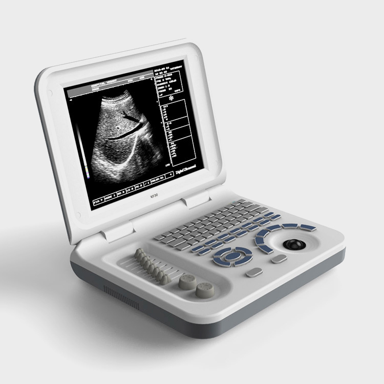 Ubw30 Escáner de ultrasonido vascular portátil en blanco y negro para humanos