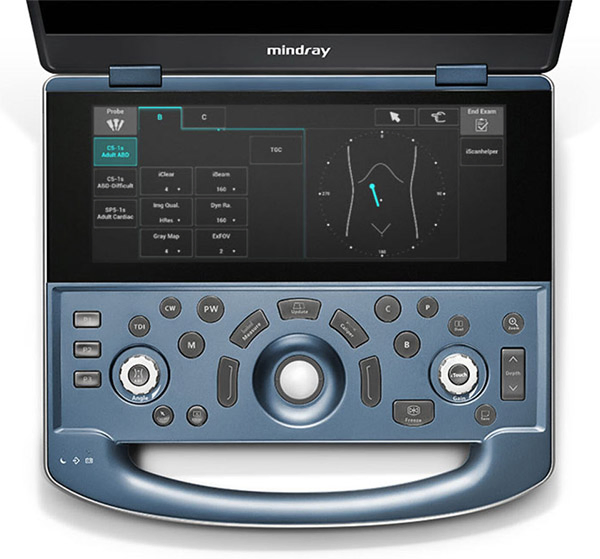 Mindray MX7 Máquina de Escáner Ultrasónico Portátil con Doppler Color 3D 4D
