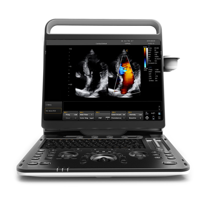 Sistema de Imagenología Diagnóstica Digital de Doppler Color Portátil Chison Ebit30 4D 5D para Ultrasonido Humano en Ginecología y Ecocardiografía Cardiovascular