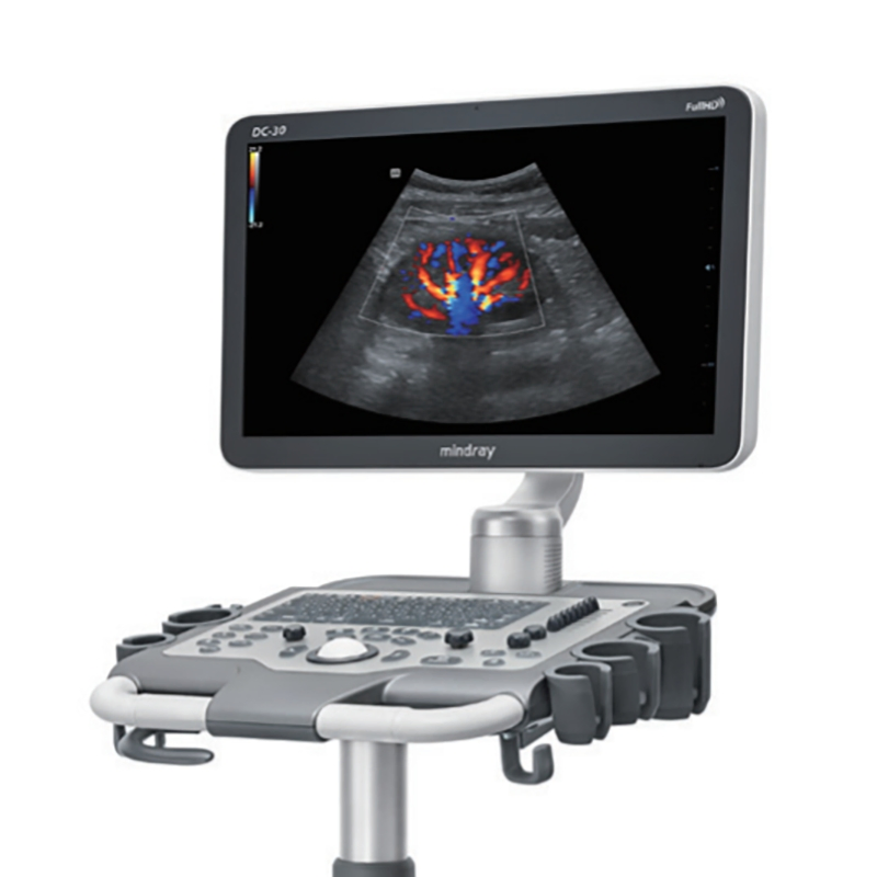 Sistema de Ultrasonido Doppler Color Avanzado Umdc-30 para Clínicas Umdc-26
