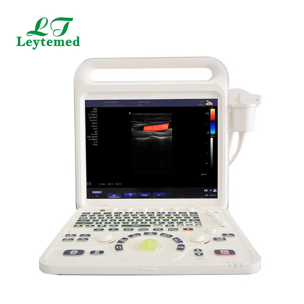 Ltub63 Urología Cardíaca Ginecología Obstetricia USG Doppler Color 4D Máquina de Ultrasonido