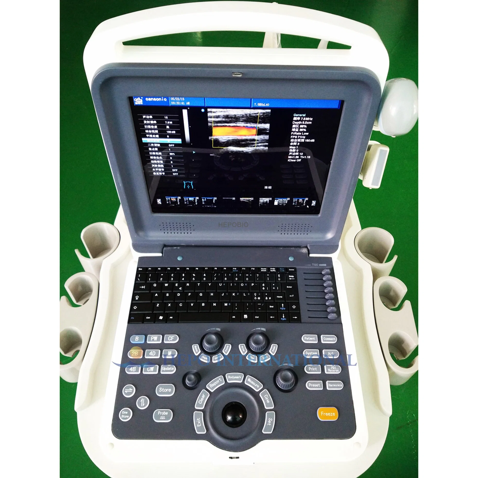 Sistema de Ultrasonido Doppler Color Portátil Cardíaco 4D para Hospital