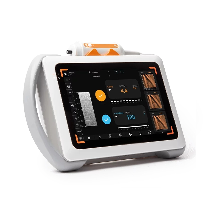 Máquina de examen de hígado de ultrasonido Fibroscan Mini Plus no invasiva de alta gama