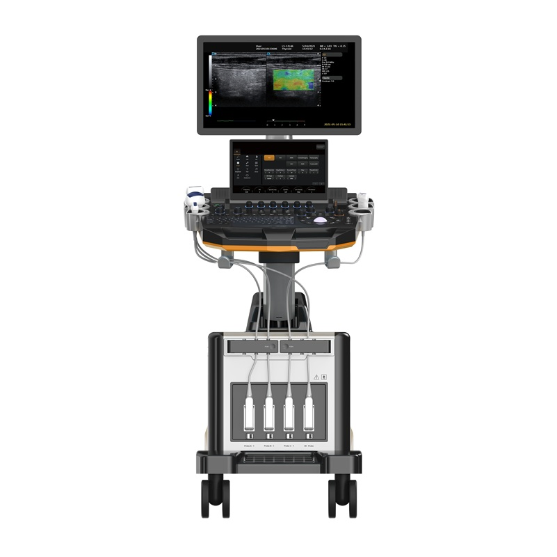 Sistema de ultrasonido Doppler color tipo carro de alta gama: imágenes avanzadas para diagnóstico de abdomen, obstetricia y ginecología, cardíaco y vascular