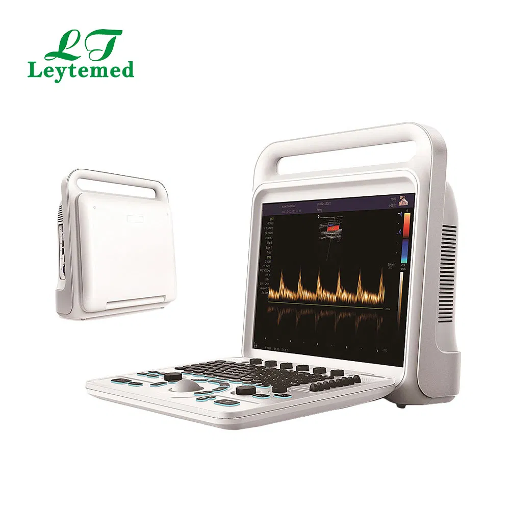 Ltub63 Urología Cardíaca Ginecología Obstetricia USG Doppler Color 4D Máquina de Ultrasonido