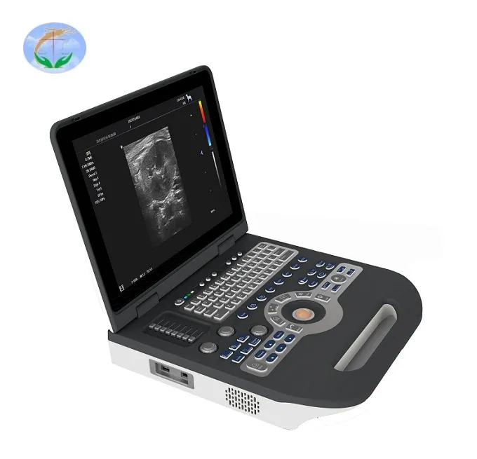 Sistema de Doppler Color PW