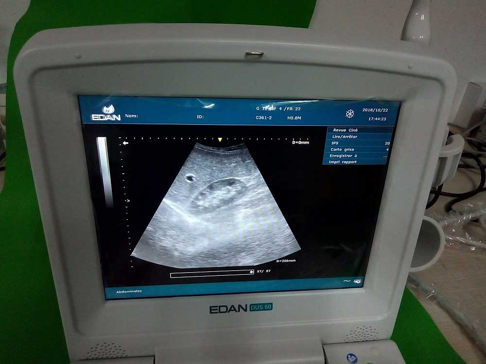 Edan Dus60 Máquina de Ultrasonido Portátil Veterinario en Venta Precio