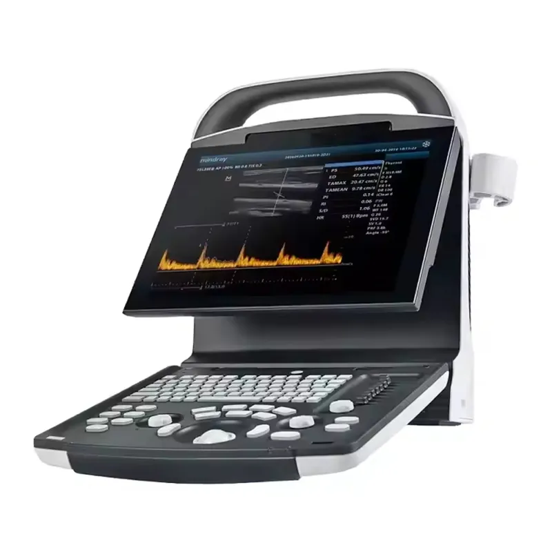 DP-30 Vista 2