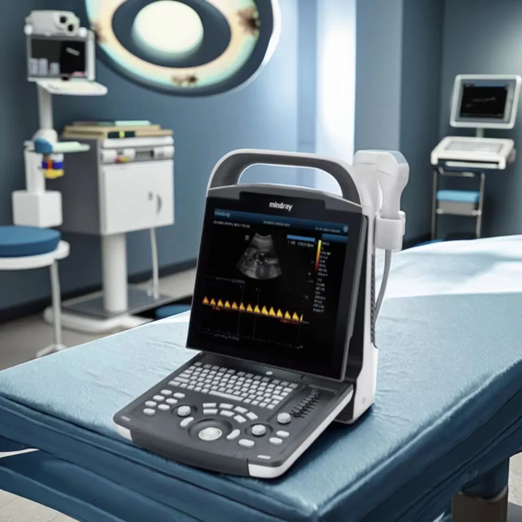 Sistema de Máquina de Ultrasonido Portátil Cardiovascular Obstetricia Ginecología Urología Máquina de Escáner de Ultrasonido