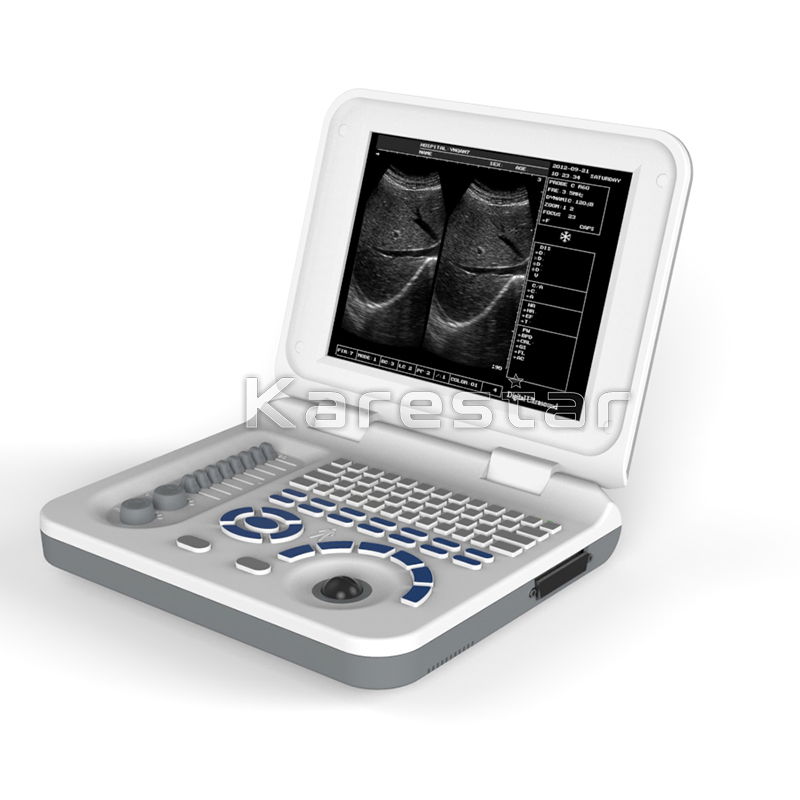 10.4'' Pantalla LED de color Instrumentos de ultrasonido médico portátil en blanco y negro Máquina de ultrasonido usada