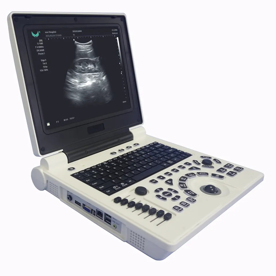 Máquina de ultrasonido veterinario digital de diagnóstico de equipos médicos Medco