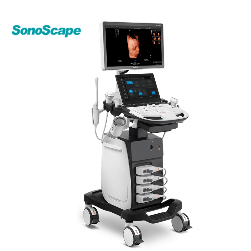 Sonoscape P11 Instrumentos de ultrasonido médico baratos Máquina de ultrasonido en blanco y negro Ecógrafo portátil Escáner de ultrasonido