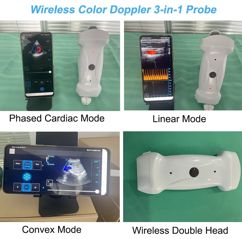 Máquina de ultrasonido portátil a color Doppler inalámbrica de alta calidad