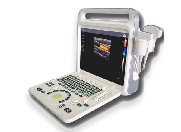 Sistema de Ultrasonido Doppler Digital a Color Xian Feng E60advanced con Sonda Convexa