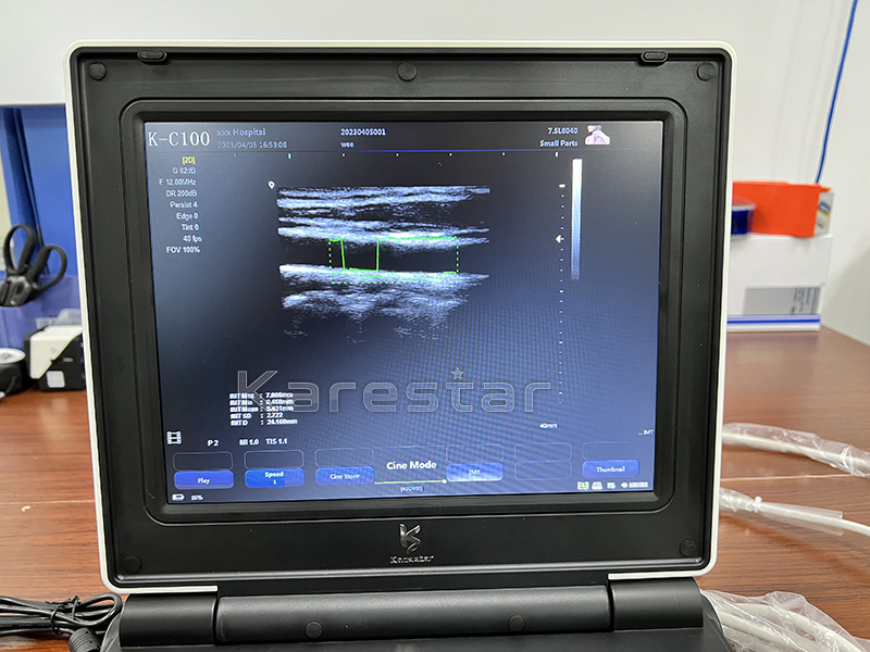 3D 4D Máquina de ultrasonido portátil con Doppler color
